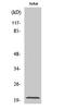 CKLF Like MARVEL Transmembrane Domain Containing 3 antibody, STJ92350, St John