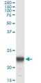 Phosphomevalonate Kinase antibody, H00010654-M07, Novus Biologicals, Immunoprecipitation image 