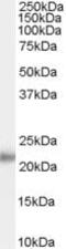 Kallikrein Related Peptidase 2 antibody, PA5-18674, Invitrogen Antibodies, Western Blot image 