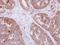 DIS3 Like 3'-5' Exoribonuclease 2 antibody, LS-C155574, Lifespan Biosciences, Immunohistochemistry frozen image 