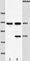 Syndecan 4 antibody, orb101265, Biorbyt, Western Blot image 