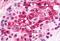 C-X-C Motif Chemokine Receptor 6 antibody, MBS246879, MyBioSource, Immunohistochemistry paraffin image 