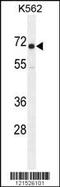 Insulin Like Growth Factor 2 MRNA Binding Protein 1 antibody, MBS9203167, MyBioSource, Western Blot image 