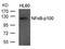 Nuclear Factor Kappa B Subunit 2 antibody, GTX50376, GeneTex, Western Blot image 