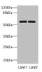 Proteasome 26S Subunit, Non-ATPase 12 antibody, LS-C676321, Lifespan Biosciences, Western Blot image 