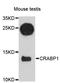 Cellular Retinoic Acid Binding Protein 1 antibody, LS-C747792, Lifespan Biosciences, Western Blot image 