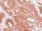 Eukaryotic Translation Initiation Factor 4A1 antibody, GTX107319, GeneTex, Immunohistochemistry paraffin image 