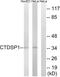 CTD Small Phosphatase 1 antibody, LS-B12528, Lifespan Biosciences, Western Blot image 