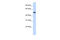 RasGEF Domain Family Member 1A antibody, 27-032, ProSci, Western Blot image 