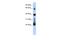 RNA Pseudouridine Synthase D3 antibody, A15760, Boster Biological Technology, Western Blot image 