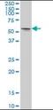 Serine/Threonine Kinase 33 antibody, orb89796, Biorbyt, Western Blot image 