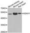 N-Acylsphingosine Amidohydrolase 1 antibody, A6527, ABclonal Technology, Western Blot image 