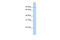 Transmembrane And Coiled-Coil Domain Family 2 antibody, 25-768, ProSci, Western Blot image 