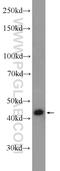 Makorin Ring Finger Protein 2 antibody, 12238-1-AP, Proteintech Group, Western Blot image 