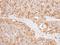 Nicotinamide Nucleotide Transhydrogenase antibody, NBP1-32109, Novus Biologicals, Immunohistochemistry paraffin image 