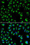 Protein Phosphatase 4 Catalytic Subunit antibody, A06390, Boster Biological Technology, Western Blot image 