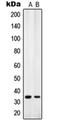 Solute Carrier Family 25 Member 31 antibody, orb215309, Biorbyt, Western Blot image 