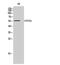 Cytochrome P450 Family 2 Subfamily E Member 1 antibody, PA5-50945, Invitrogen Antibodies, Western Blot image 