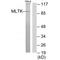 Mitogen-activated protein kinase kinase kinase MLT antibody, A00902, Boster Biological Technology, Western Blot image 