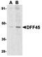 DNA Fragmentation Factor Subunit Alpha antibody, orb74330, Biorbyt, Western Blot image 