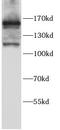 MutS Homolog 6 antibody, FNab10369, FineTest, Western Blot image 