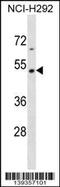 Tektin 2 antibody, 60-436, ProSci, Western Blot image 