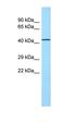 Torsin 1A Interacting Protein 2 antibody, orb326608, Biorbyt, Western Blot image 