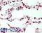 Chromobox 4 antibody, LS-B12407, Lifespan Biosciences, Immunohistochemistry paraffin image 