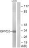 G Protein-Coupled Receptor 35 antibody, abx015327, Abbexa, Western Blot image 