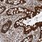RIO Kinase 3 antibody, NBP1-86982, Novus Biologicals, Immunohistochemistry frozen image 