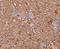 Calpain Small Subunit 1 antibody, NBP2-80453, Novus Biologicals, Immunohistochemistry paraffin image 