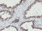 N-Myristoyltransferase 2 antibody, M07621, Boster Biological Technology, Immunohistochemistry paraffin image 