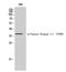 Casein Kinase 1 Alpha 1 antibody, STJ90942, St John