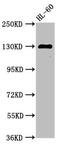 Signal-Induced Proliferation-Associated 1 antibody, CSB-PA021330LA01HU, Cusabio, Western Blot image 