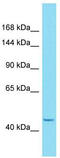 HEAT Repeat Containing 6 antibody, TA337340, Origene, Western Blot image 