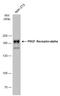 Platelet Derived Growth Factor Receptor Alpha antibody, GTX133619, GeneTex, Western Blot image 