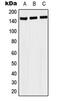 NAC Alpha Domain Containing antibody, MBS821584, MyBioSource, Western Blot image 