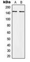 Palladin, Cytoskeletal Associated Protein antibody, LS-B13649, Lifespan Biosciences, Western Blot image 