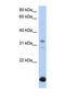 Beta-1,3-Galactosyltransferase 6 antibody, NBP1-69627, Novus Biologicals, Western Blot image 