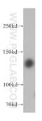 Histone Deacetylase 4 antibody, 17449-1-AP, Proteintech Group, Western Blot image 
