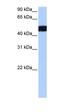 Putative ciliary rootlet coiled-coil protein-like 2 protein antibody, orb325682, Biorbyt, Western Blot image 