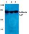 SRBP1 antibody, PA5-36044, Invitrogen Antibodies, Western Blot image 