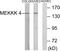 Mitogen-Activated Protein Kinase Kinase Kinase Kinase 4 antibody, LS-C118740, Lifespan Biosciences, Western Blot image 