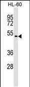 Germ Cell Associated 1 antibody, PA5-48832, Invitrogen Antibodies, Western Blot image 