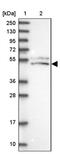 Solute Carrier Family 24 Member 3 antibody, PA5-60349, Invitrogen Antibodies, Western Blot image 