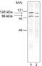 Drebrin 1 antibody, PA1-20222, Invitrogen Antibodies, Western Blot image 