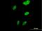 Sorbin And SH3 Domain Containing 3 antibody, H00010174-B01P, Novus Biologicals, Immunofluorescence image 