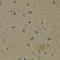 Arachidonate 5-Lipoxygenase antibody, LS-C331942, Lifespan Biosciences, Immunohistochemistry frozen image 