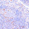 Inhibitor Of Nuclear Factor Kappa B Kinase Subunit Epsilon antibody, 13-103, ProSci, Immunohistochemistry frozen image 