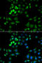 Hypoxia Up-Regulated 1 antibody, STJ114199, St John